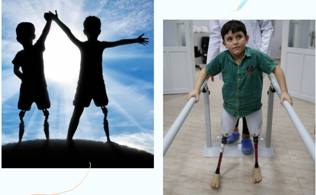 兒童假肢一定要裝嗎？